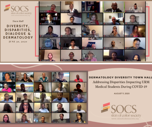 SOCS Fosters Virtual Connection through the Dermatology Diversity Town Hall Series-banner-image