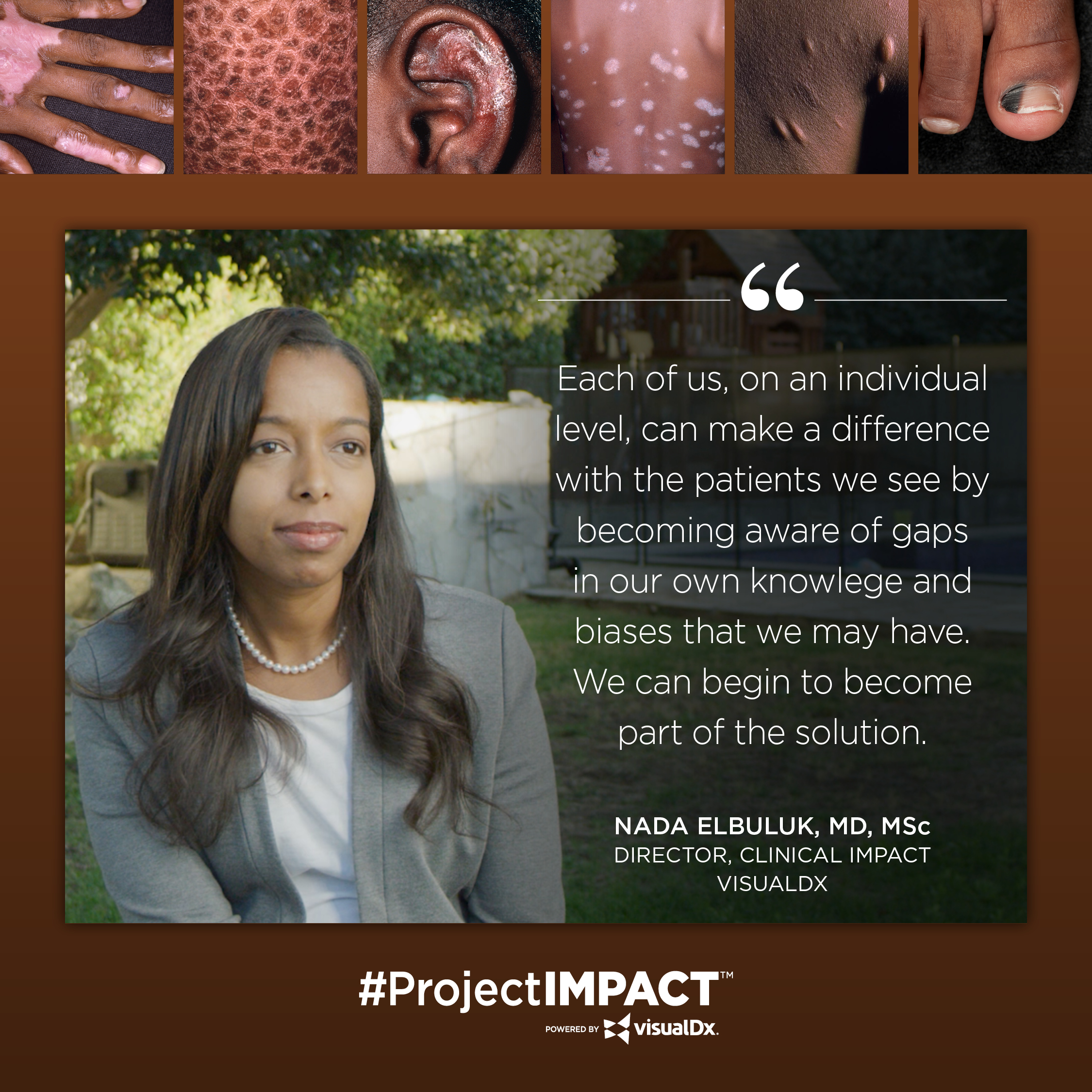 Reducing Healthcare Disparities, Bridging Gaps of Knowledge and Improving Outcomes for Patients of Color through Project IMPACT-banner-image